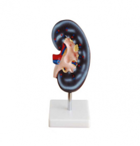 What is the role of kidney profile model in teaching and medical training?