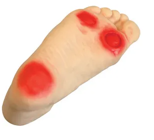 Why is diabetic foot care model important in medical education