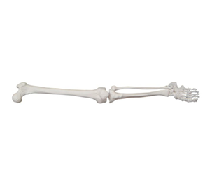 Can lower limb bone models help clinical practice?