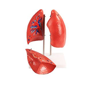 Why are lung anatomical models so important in medical education?