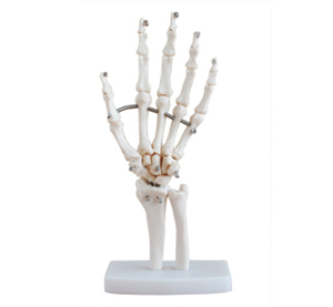 Why is the hand joint model particularly important in early intervention?