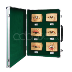 BIX-A1060 Common Eye Disease Model: 20-Piece Teaching Set