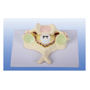 Fifth Cervical Spinal Cord And Spinal Nerve Enlargement Model Spine Models Henan Bomn Supply Fifth Cervical Spinal Cord And Spinal Nerve Enlargement Model Spine Models Henan Bomn Supply