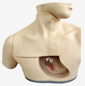 Parenteral nutrition Nursing model